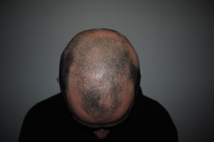 My head in January 2014