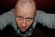 Alopecia hair July 2013