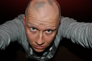 Alopecia hair July 2013