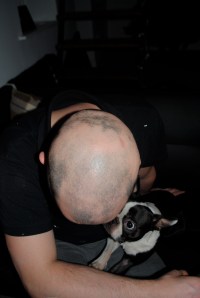 December 2013 Alopecia regrowth