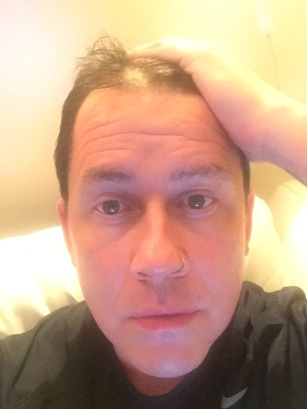 Bald patch at the front - January 2017