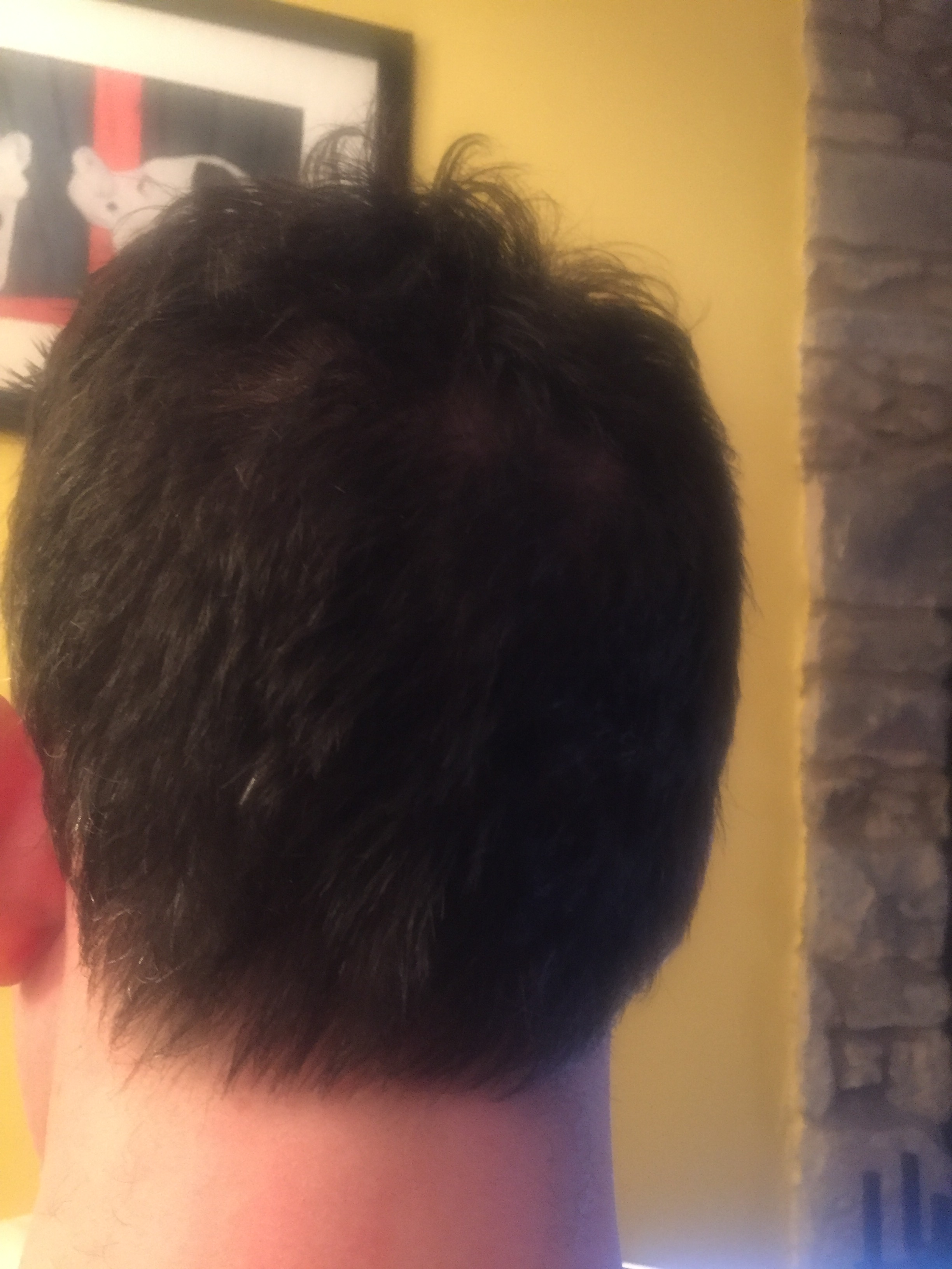 The back of my head January 2017